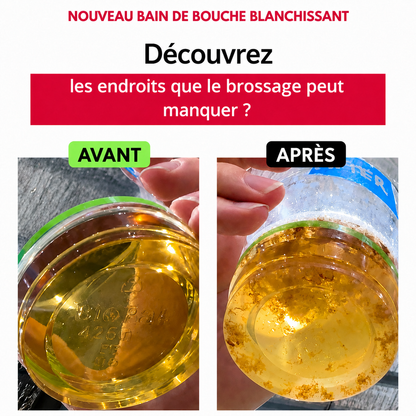 Bain de bouche blanchissant iD Stain