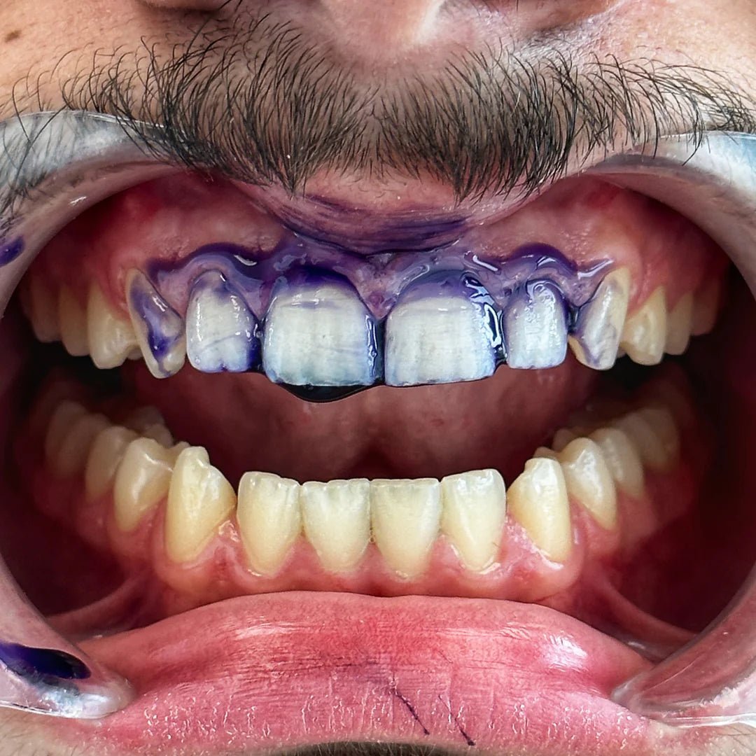 Sérum Blanchissant V34 - Luvéa