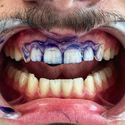 Sérum Blanchissant V34 - Luvéa